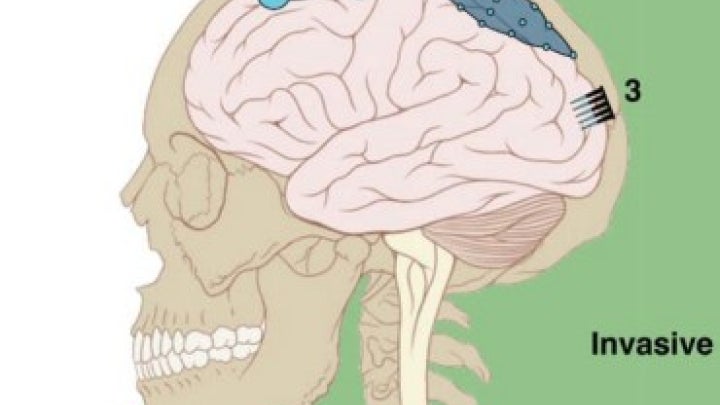 Brain machine interface